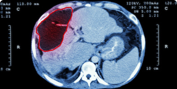 Detección de objetos médicos